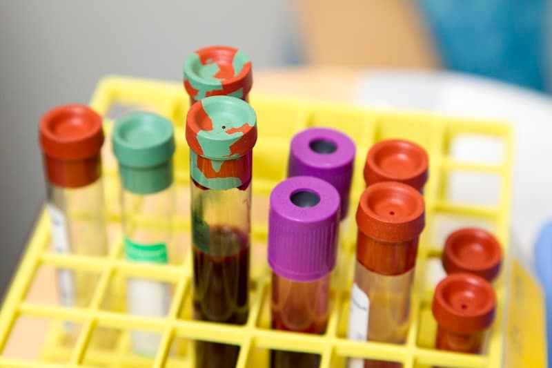 Blood test tube labeled ferritin next to magnesium supplements — checking iron when magnesium isn't working